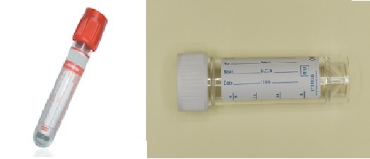 Cryptococcal Antigen
