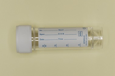 Cerebrospinal Fluid (CSF) Cerebrospinal Fluid (CSF)