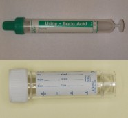 Urine Microscopy & Culture
