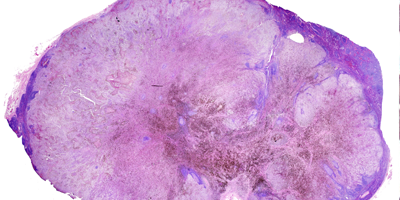 Cellular Pathology