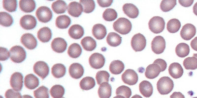 Haematology